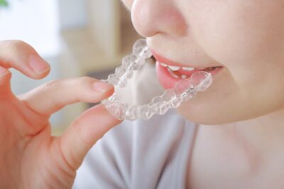 マウスピース矯正各種比較のアイキャッチ画像