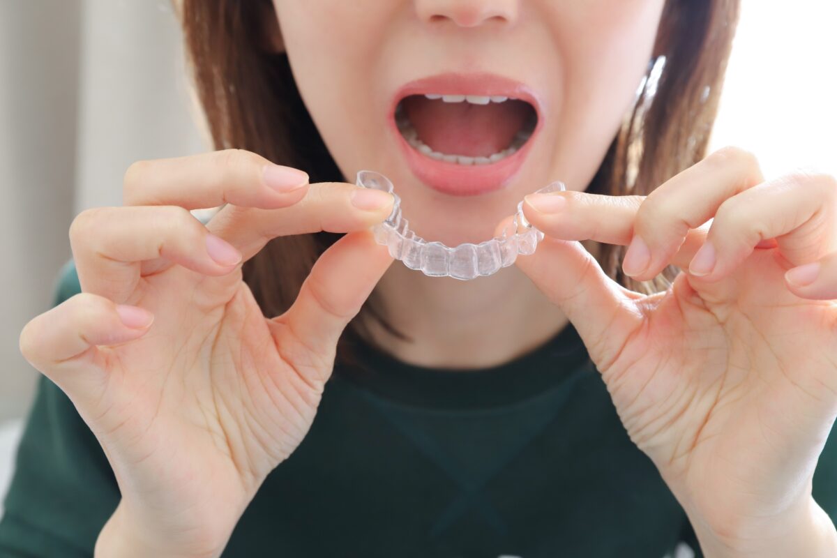 マウスピース矯正の基本